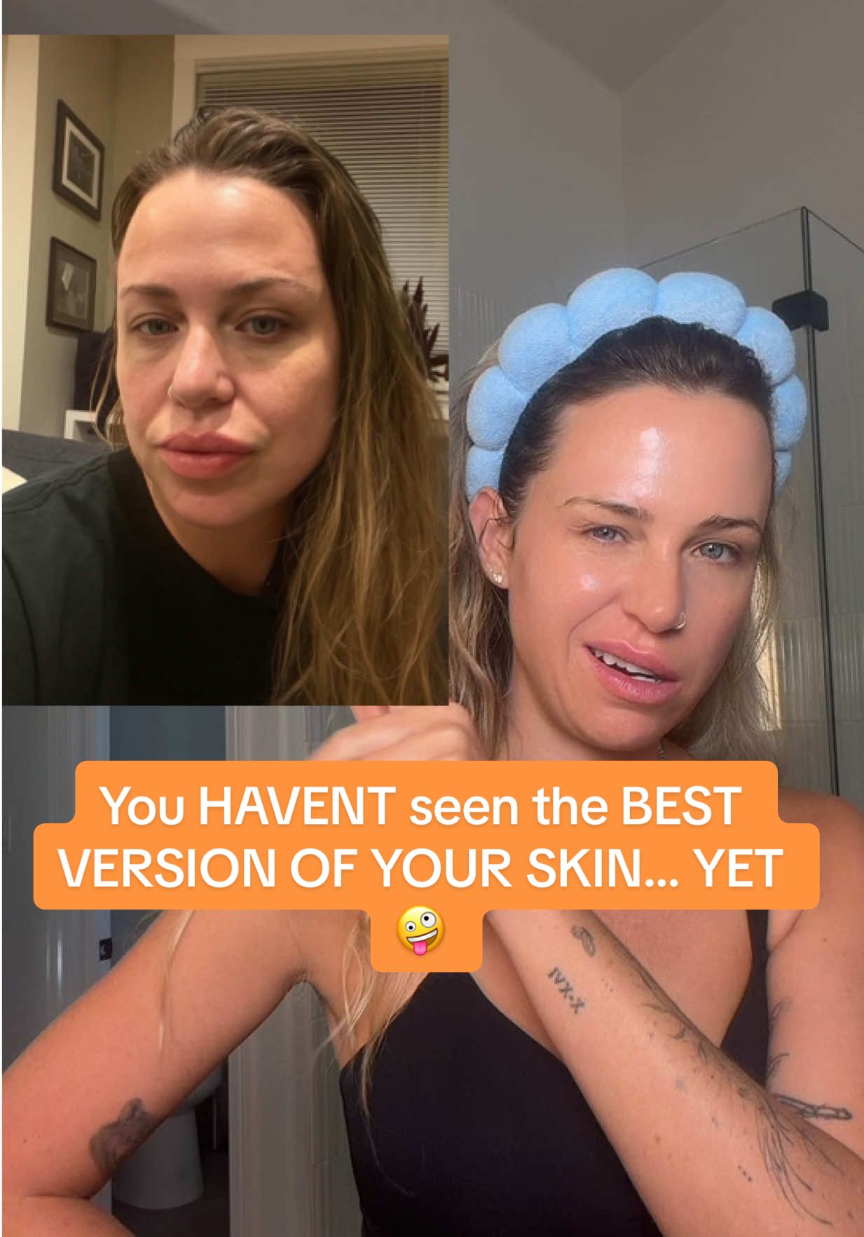 The most effective one step solution for anti aging. #antiaging #antiagingskincare #womenover30 #growthfactors #drmtlgy 