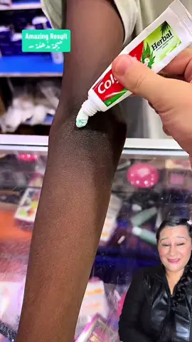 Uau😍😍😍😍 #beauty #beautyhacks 