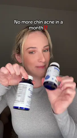 chin acne is usually a sign of a hormonal imbalance #smnutrition #acne #hormones 