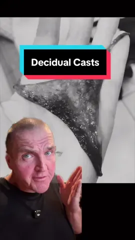 What is a decidual cast? And what causes them? #TikTokLearningCampaign #Science #anatomy #medical