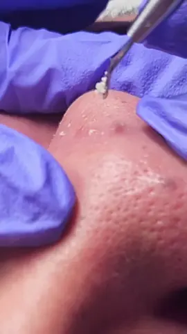 #beautybymelania #esthetician #permanentmakeup #makeup #beforeandafter 