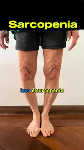 Sarcopenia, você tem e nem sabe! É a perda de massa muscular e força, mas é possível reverter sem remédio  Com os exercícios adequados de movimentos e força a retomada da massa muscular acontece Então já comece fazendo esses 3 exercícios propostos nesse vídeo. E aí curtiu? Então já passe a me seguir pra não perder nenhum vídeo novo semanalmente  Comenta aqui: Você já sente a sarcopenia? Compartilhe esse vídeo com seus amigos que reclamam da perda de massa muscular e força! #mae #sarcopenia #terceiraidade #idoso #joelho 