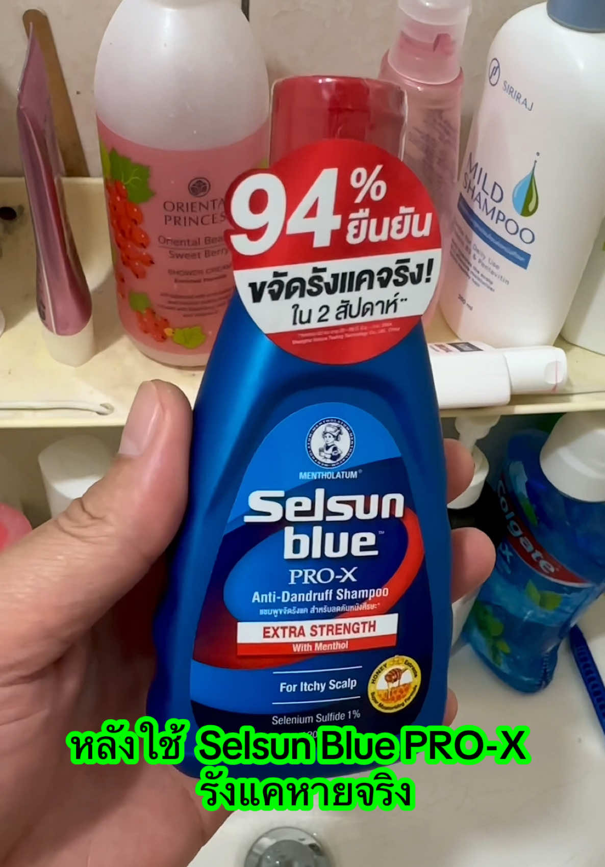 เป็นรังแคอยู่ใช่ไหมครับ ลองเปิดใจใช้ตัวนี้ดู #รีวิวจริงใช้จริง #SelsunBlue #แชมพูขจัดรังแค #ของมันต้องมี #รังแคหายจริง