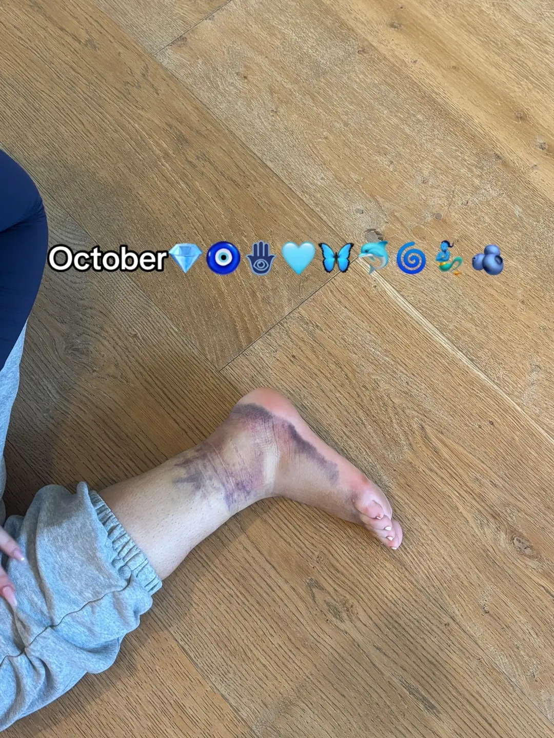 Posting early bc bored 