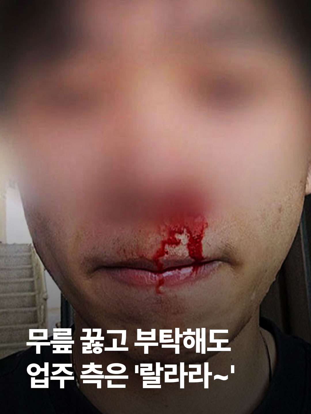 '지게차 학대' 사건이 알려진 후 대통령까지 나서 경고를 했지만, 이주노동자 인권침해 사례는 끊이질 않습니다. #JTBC뉴스 #뉴스룸 #이주노동자 #이주노동자인권침해 #이주노동자학대