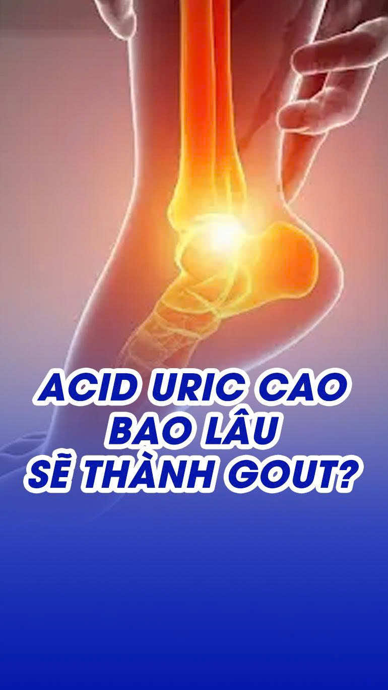 Acid uric cao bao lâu thành bệnh Gout #gout #xuhuong #viral #suckhoe 