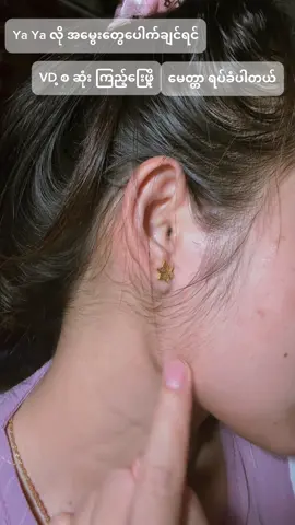 ကျား မ မရွေး အသုံးပြုနိုင်ပါကြောင်း #growhair #babyhair #lovestory #foryoupage #fyp 