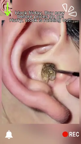 The ONLY ear care kit you'll ever need! 😌 #SelfCareSunday #BlackFriday ​​ #EarCleaning #EarWaxRemoval #SelfCare     