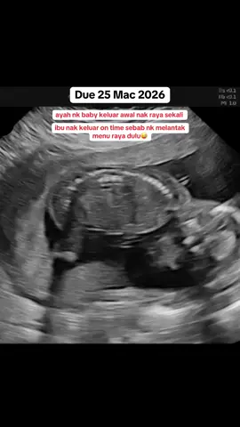 Ada yg due sama tak? Nak baby keluar on time ke keluar awal?🤭 #scanbaby #pregnant #ultrasound #secondtrimester #scanbabyjerteh 