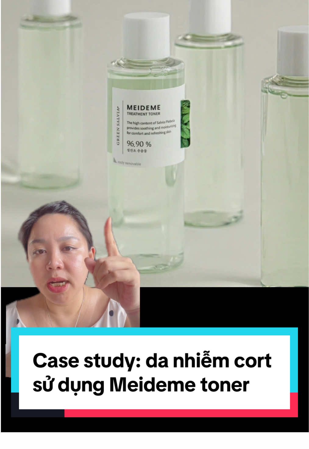 Sau một thời gian mình đã phải suy nghĩ rất kỹ xem liệu có bị thiên vị và khen #tonermeideme quá không nhưng chính hàng 100 hàng 1000 ca như thế này và những lời feedback từ chính những bạn đã sử dụng qua #rượuthuốc #kemtrộn mà phục hồi được với chỉ một sản phẩm rẻ mà tốt như thế này đã giúp mình càng khẳng định trong lòng sự trung thành với một nhãn hàng đáng tin cậy và chất lượng công thức cực kỳ cao là đúng đắn!
