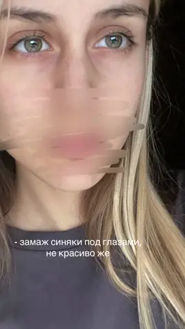#fypp #рекомендации #продвижение #синякиподглазами 