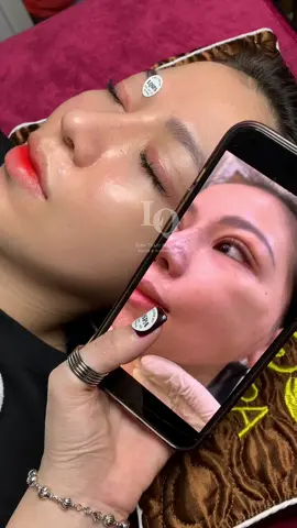 Cập nhật da sạm #chamsocdamun#chamsocdaseo#chamsocdanam#tanbinh#Lqspa 