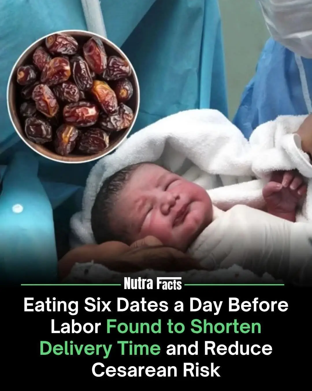 Eating six dates daily in the four weeks before your due date may improve labor, a study found. Women who did this were, on average, 74% more dilated on arrival and had a 44% shorter first stage of labor. They were also over 40% less likely to need medical induction. Allah Subahanahu Wa Ta'ala Says in the Qur'an; • And the pains of childbirth drove her to the trunk of date-palm. She said: “Would that I had died before this, and had been out of sight (and) completely forgotten. • Then (the angel) called out to her from (a place much) lower down to her, (saying) that: “Grieve not! Surely, your Nourisher-Sustainer has provided underneath you a stream of running water • And shake the trunk of this palm tree towards you, it will drop fresh, ripe dates upon you. • So eat and drink, and put your heart at ease. But if you see any of the people, say, ‘I have vowed silence to the Most Compassionate, so I am not talking to anyone today.’” (Qur'an - 19 : 23, 24, 25, 26)