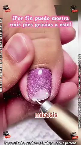 ¿Qué utilizamos para tratar la onicomicosis?  #onicomicosis#nails  #fyp#TikTokShopfalldealsforyou#TikTokShopBlackFriday