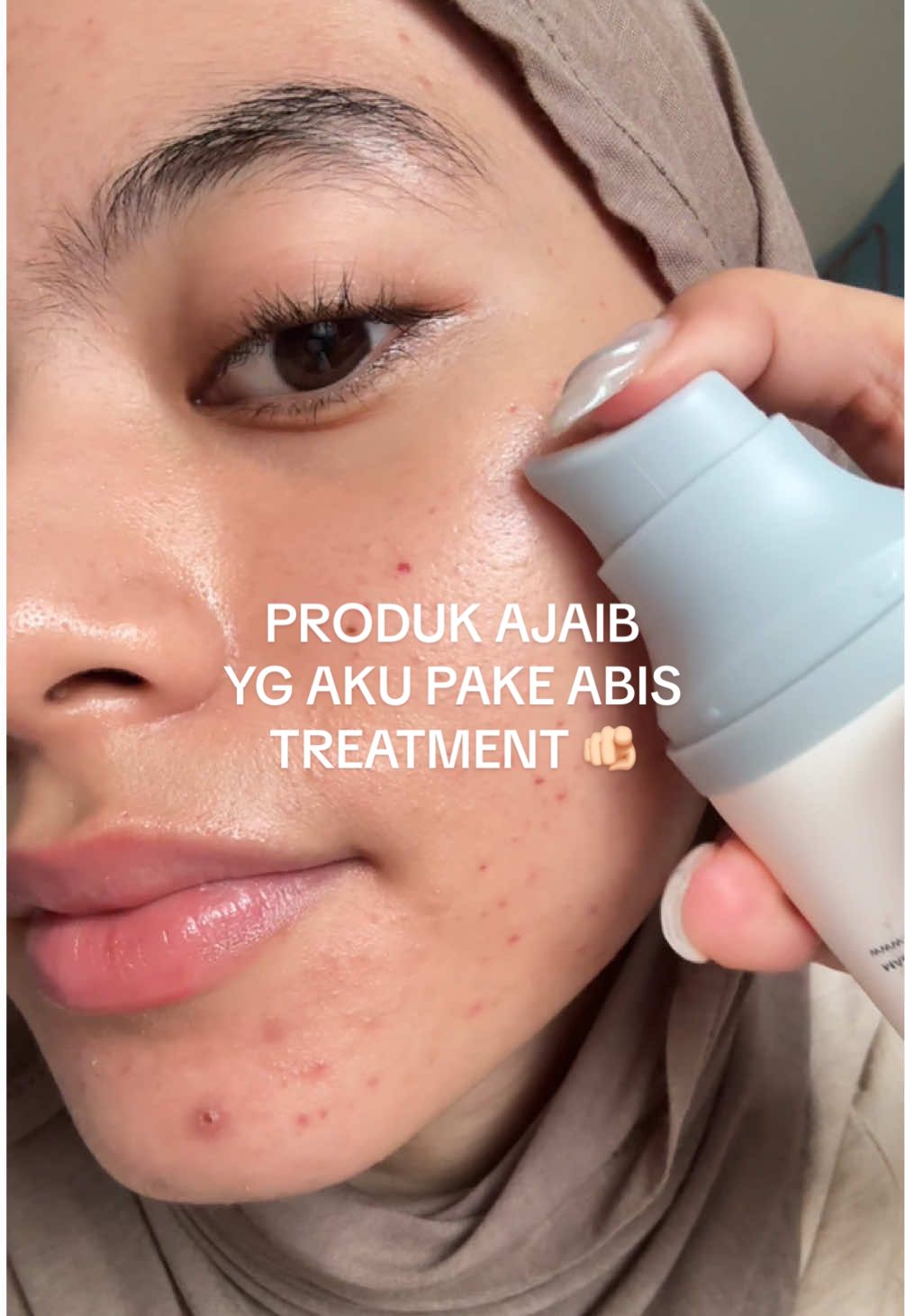 produk yang aku pake abis treatment #treatment #sunscreen #rekomendasiskincare #reviewproduk #SKIN1004Crew 