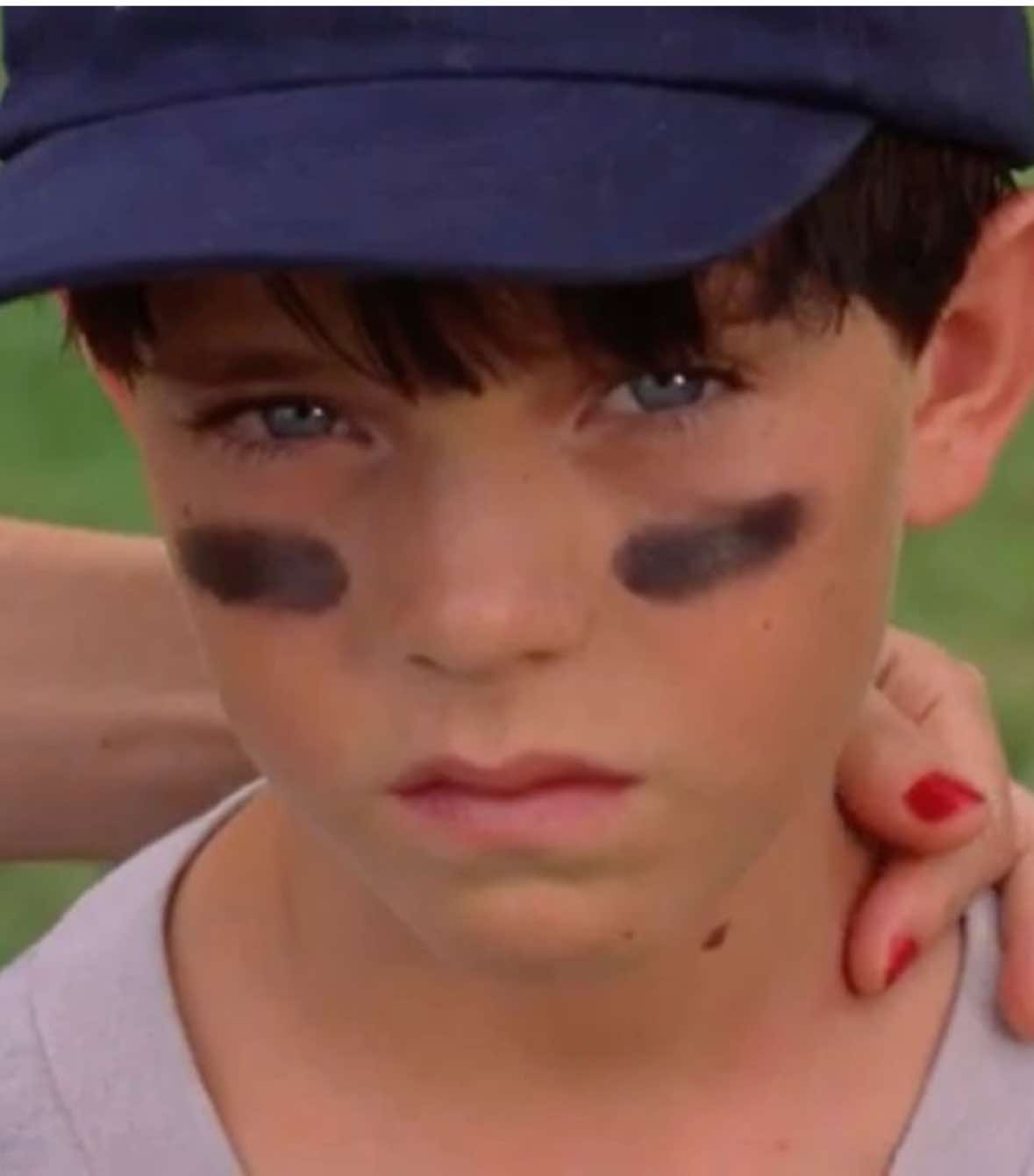 TW: SA #mysteriousskin #neilmccormick #fyp #brianlackey #edit 