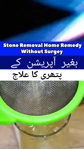 without any surgery remove stone home remedy pathari ka ilaj ghar ka nuskha bgair operation #stoneremoval #homeremedy 