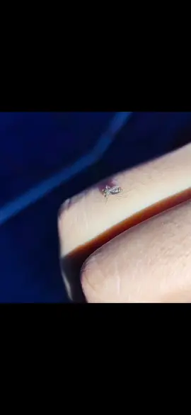 ကိုက်စေ🥴 #ခြင်🦟