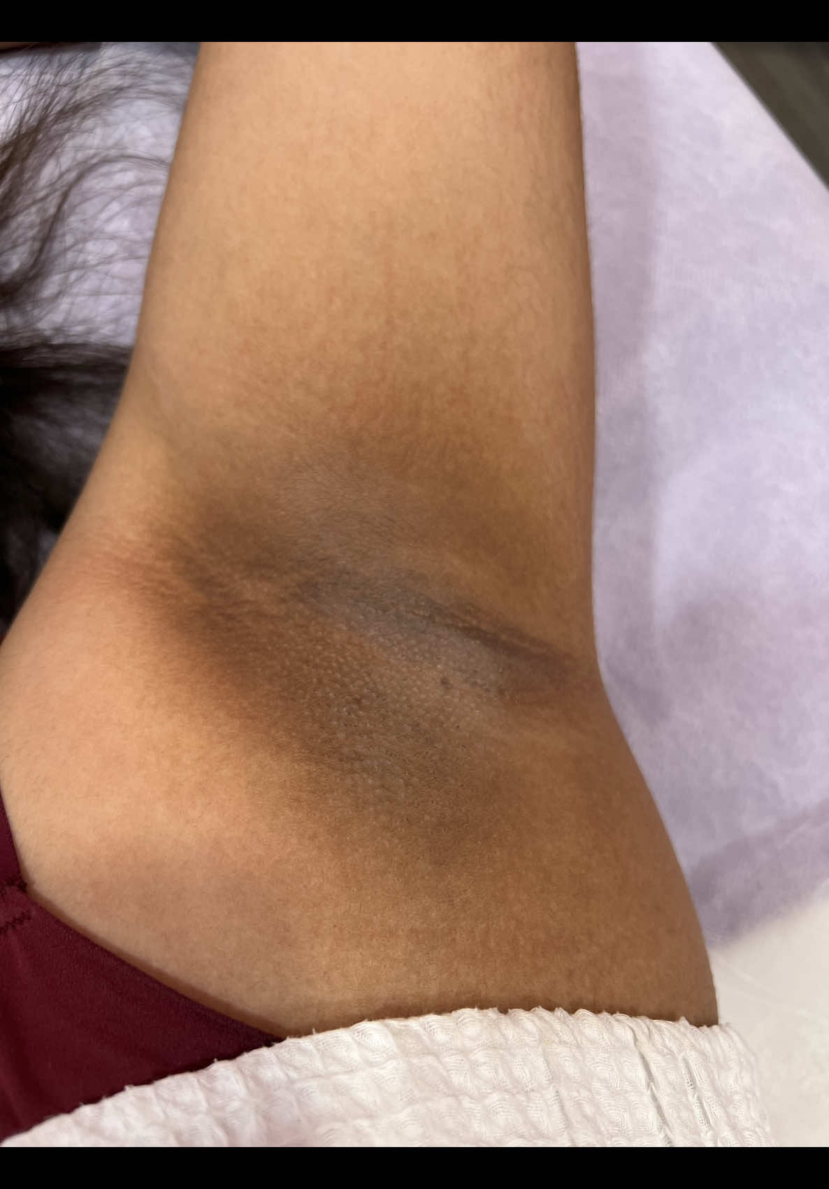 Blanqueamiento de Axila , cuello, Zonas y mucho más #blanqueamiento #axilasoscuras #viraltiktok #tiktokshop #parati @Elsa Oseguera @cristhian Ramirez @Frankofficialive🐸👑 @Delia🖤 @katerinne vasquez @Roxana @@5estrellas_1 @💚Lesly Moya👸🏻 @Arelys Kitchen @Barbysboutique_ @Flores fragrance &More @NANCYYTUQUE @Team lidia1🌈 @Camilo @Los_chicaneros @milagrofloresoficial👑🇭🇳 