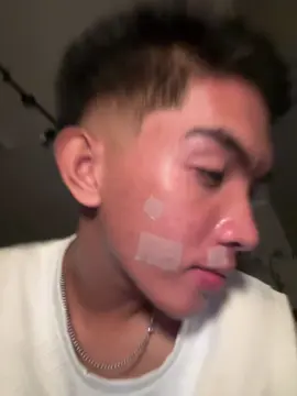 👀#silicone #scar #acneremove #xybca #fyp 