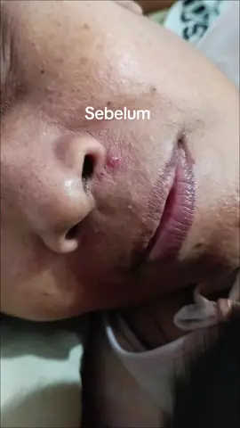 #hansaplast #healfasterlikesecondskin #tenangbawahansaplast #Secondskin #hansaplastsecondskinprotection 