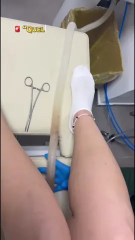 💭 “Molti ne parlano… ma pochi sanno davvero cos’è l’idrocolonterapia. Non è una moda, e non è magia. È un trattamento sanitario che, in mani esperte, può aiutare chi soffre di gonfiore, stitichezza o pesantezza addominale. Da Fidatis Digital Health ogni seduta è eseguita da personale sanitario qualificato, con dispositivi certificati CE. 💚 La differenza non è la macchina, ma la competenza di chi la utilizza.” 👉 Prenota la tua valutazione al 379 237 9244 #FidatisDigitalHealth #Idrocolonterapia #SaluteIntestinale #BenessereConsapevole #centromedico 