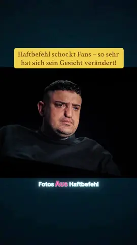 Haftbefehl schockt Fans – so sehr hat sich sein Gesicht verändert! #haftbefehl #gesicht #verändert #fyp #viralvideos 