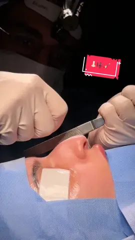 عزفناها صح؟🎼 #تجميل #rhinoplasty #تجميل_الانف 