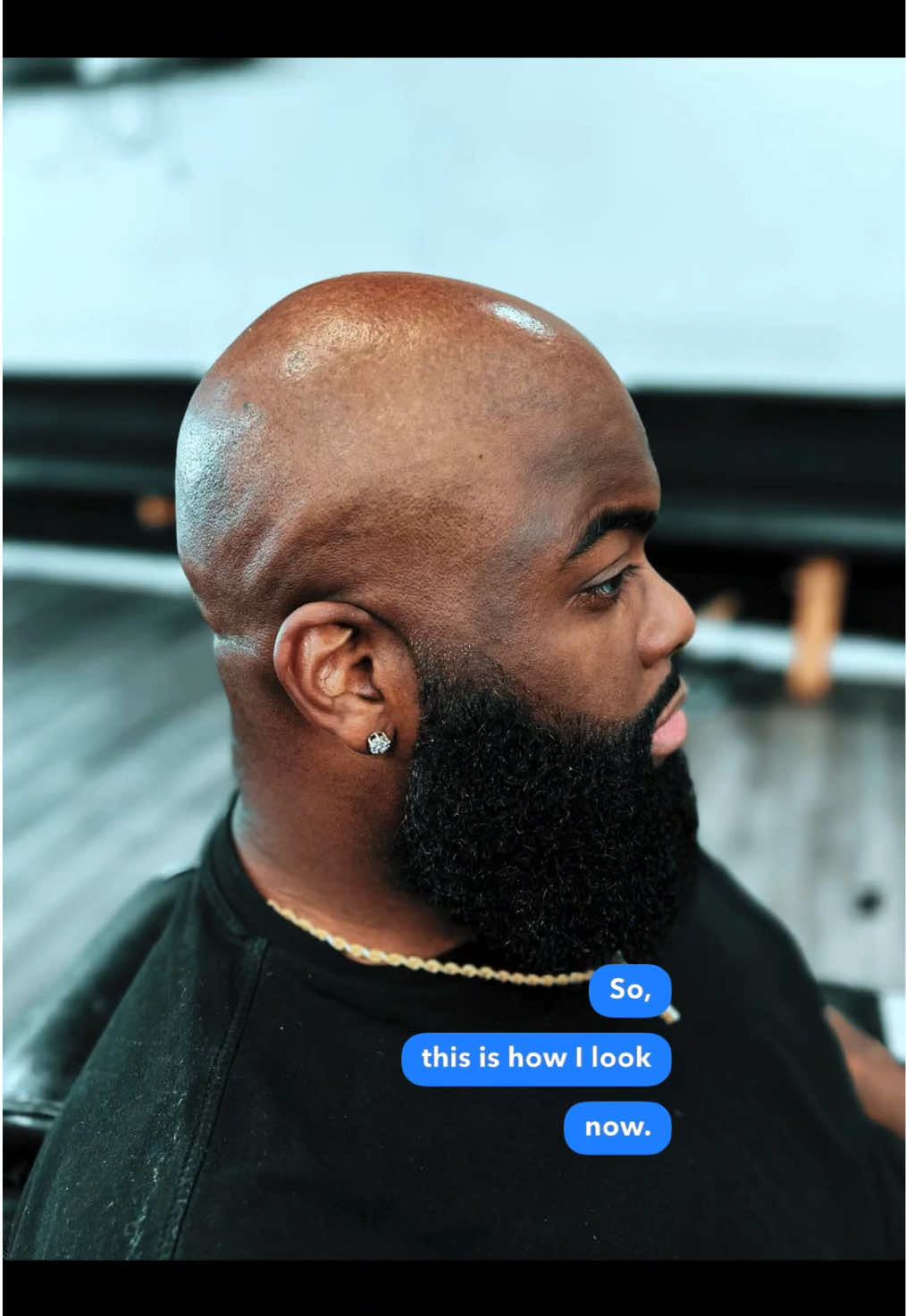 Sometimes you gotta let it go… #hair #life #hairloss 