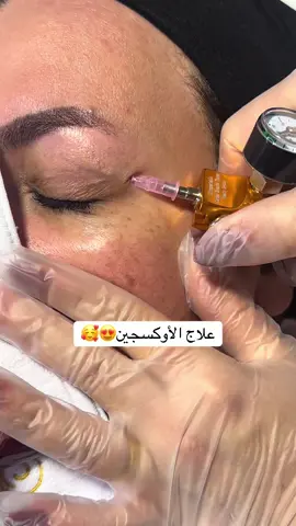 #danmark🇩🇰 #دنمارك🇩🇰 #عفرين #بيوتي 