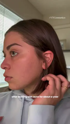 just a girl finding solutions for my skin with kbeauty✨ @VT Cosmetics US @4AM Marketing – Saebyeok Naesi  #VTCosmetics #glycolicacid #exfoliatingmist #headtotoemist #amazonfinds