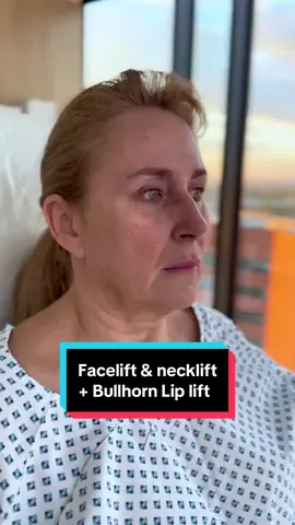 1 day after deep plane facelift, deep necklift and bullhorn lip lift👌 All done under local anesthesia💪 Stay tuned for the healing process and final results👀 📲If you want to make an appointment, contact us at contact@v-clinic.cz #facelift #necklift #bullhornliplift #plasticsurgery
