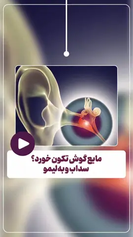 #گوش #درمان #مایع  #5  #4 