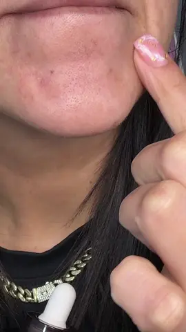 #skincare #drmelaxin #drmelaxinpeelshot 