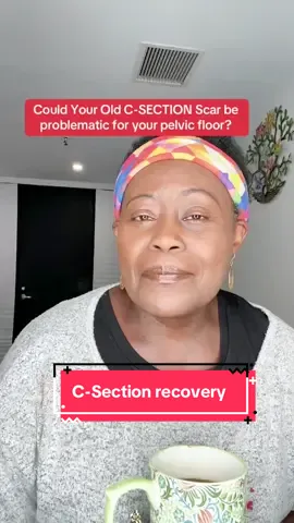 👉🏿An old C-section scar can cause problems later, such as chronic pain, or abnormal uterine bleeding, due to scar tissue defects or adhesions.  ⁣  ⁣ C-section scar tissue is strands of collagen that form in the body after the surgery. ⁣ ⁣ 🙃Unfortunately, they are rarely discussed and many patients have never heard the term ‘adhesions.’ Because they are part of the body’s natural healing process, there is no way to prevent adhesions from forming.  ⁣ ⁣ ✨Massage and working on the scar tissue (once it has healed) is highly recommended, but most people do not know that, or even have an idea of where to start.⁣  ⁣ C-section scar tissue can cause problems many years down the road. The good news is that it is never too late to address them.⁣ ⁣ Issues with multiple pregnancies:⁣ ⁣ Each C-section adds a scar, which can increase the risk of placenta problems in future pregnancies. ⁣  ⁣ Pain can also be caused by adhesions (scar tissue bands) that stick to internal organs, or from the scar tissue itself irritating nerves. 😟 ⁣ —-/-/ ⁣ ⁣ #menopauseremedies ⁣ #menopauseadvice ⁣ #pelvicfloormuscles ⁣ #pelvicfloorhealth  #csectionscar ⁣  