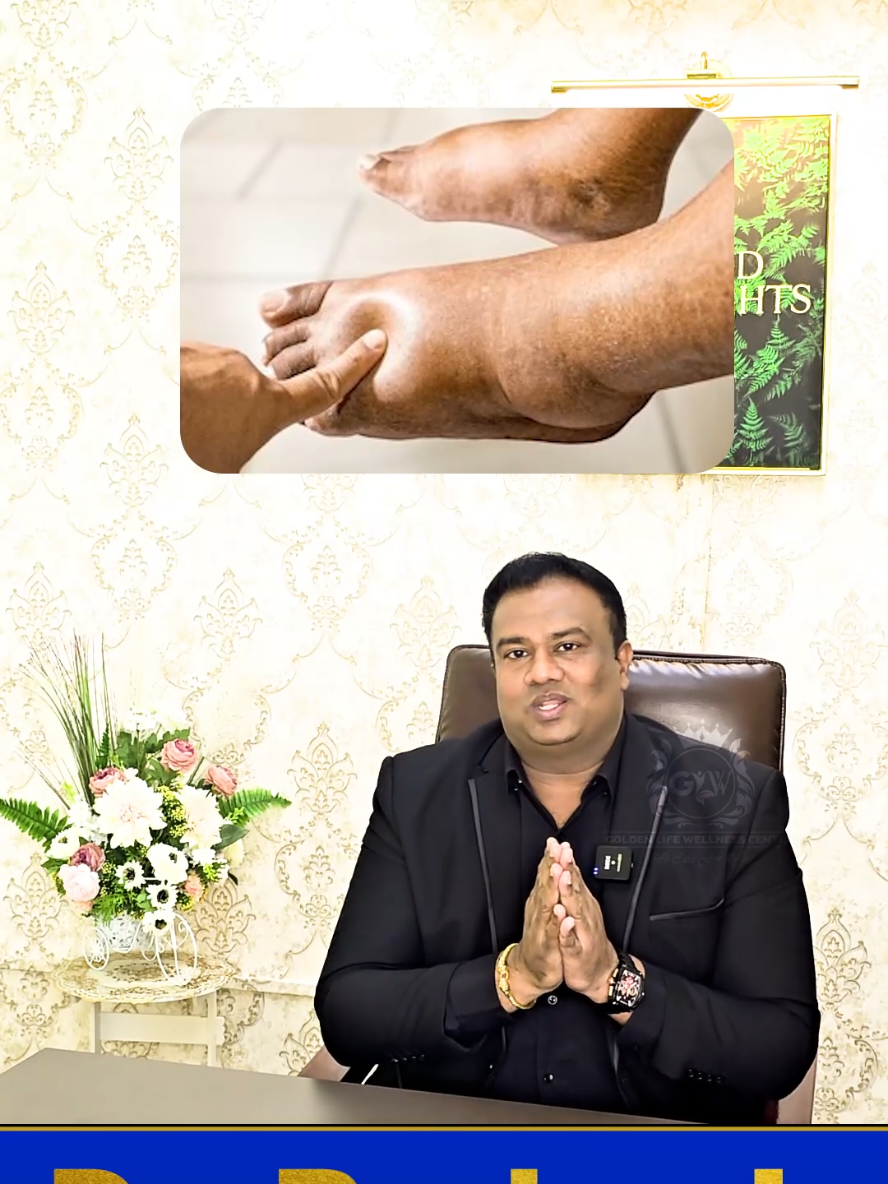 Kidney Disease Stages/EGFR Awareness/Kidney Disease Symptoms/Chronic Kidney Failure/Dialysis/Kidney Function/EGFR Awareness* Sharing by Dr.Prakash  Mbbs,M.S(Ortho),M.D(Alt.Med) Traditional Wellness Consultant  Golden Life Wellness Centre Sdn Bhd LOT-90-3A-2F,Bangunan Lot 90,2nd Floor,Jalan S10/4, Bandar Kajang, 43000 Kajang, Selangor, Malaysia  Call / Whatsapp - 0129930499. http://www.wasap.my/60129930499. Thank you #kidneydisease  #kidneyhealth  #kidneyfailure  #rawatandialisis  #pesakitbuahpinggang     