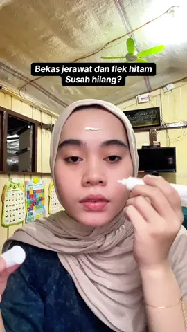 Nga ada lagi drama flek hitam dan bekas jerawat yg susah hilang💅🏻😍#chalonese #chaloneseskincare #flekhitam #bekasjerawat #fyppppppppppppppppppppppp 