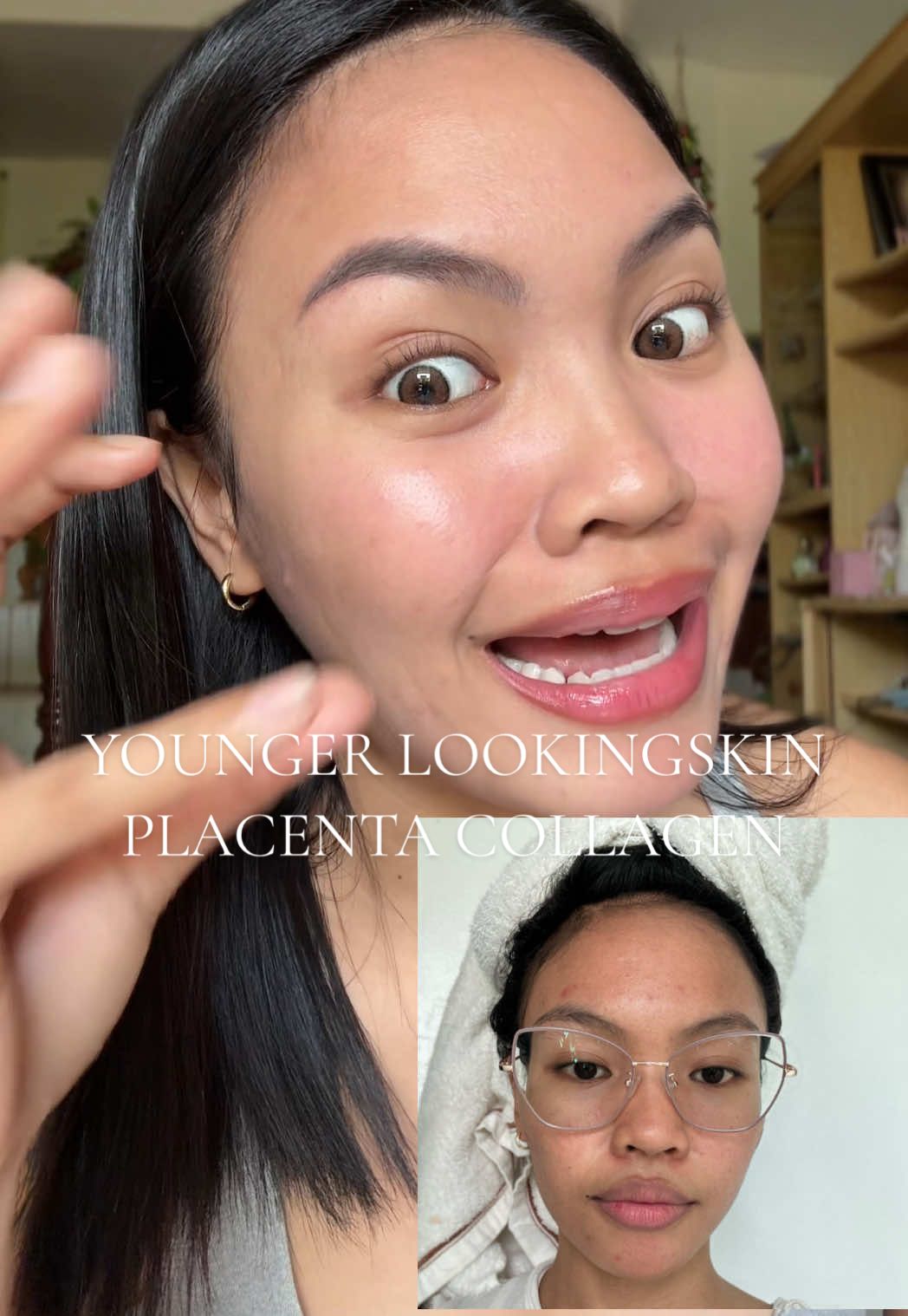 Iba ang ganda pag Nag Placenta Collagen ka! #fyp #inneryoujourney #placenta #glowingskin 