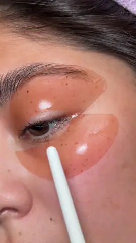 ISOI TikTok shop is live- don’t miss these insane deals !!  Fix it with the jelly rose eye patch🌹 @ISOI #Kbeauty #ISOI #Ad #eyemask ##rosyglow 