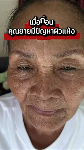 เติมความชุ่มชื้นให้ผิว นุ่ม เด้ง เหมือนผิวเด็กอีกครั้ง #IMURA #อิมูร่า #อิมูร่าโลชั่น #อิมูร่าลิปมาส์กดราก้อนบลัด