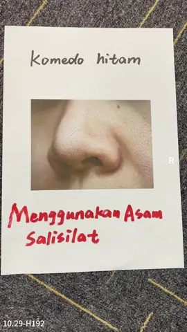 Diformulasikan untuk kulit bersih maksimal tanpa rasa ketarik 🌸#facialwash #facewash #chalonesefacialwash #chaloneseskincare #rekomendasiskincare #wajahcerah #freshlook #gentlefacewash #sabuncucimuka #bpomdanhalal✅ #skincareroutine #foryourbeauty #skincareviral #ForYourBeauty #promogajian #paydaysale #fyp #pestagajian #skincarecowok