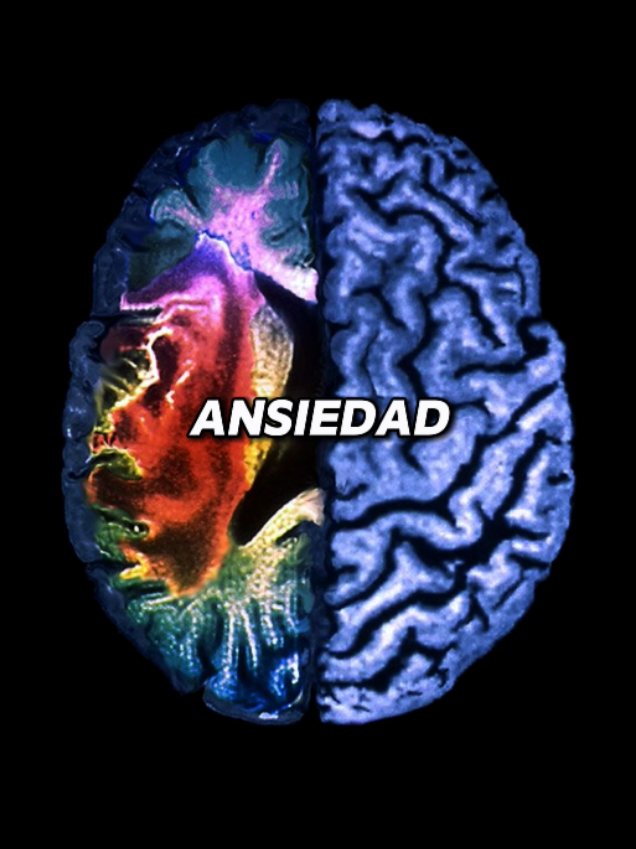 La ansiedad no es miedo, es un sistema sobreactivado #psicologia #ansiedad #neurociencia #mentehumana #cognicion 