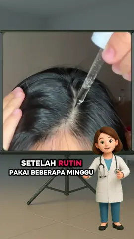 Janga tunggu sampai botak