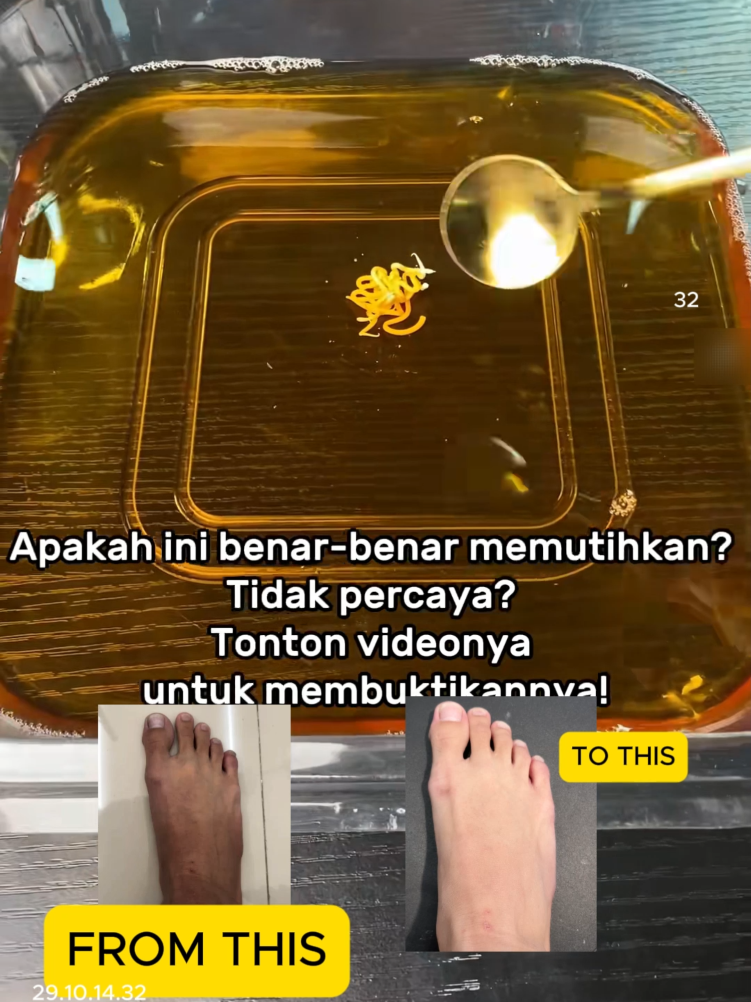 tidak percaya sama kehebatan cerahin dari cream ini? tonton video ini dan buktikan hasilnya🥰😉#rekomendasiskincare #fyppppppppppppppppppppppp #bumilbusuiaman🥰 #skincareroutine #bpomdanhalal✅ #masukberanda #chalonese #viralvideo #kulitglowing #kulitsehat #brighteningcream