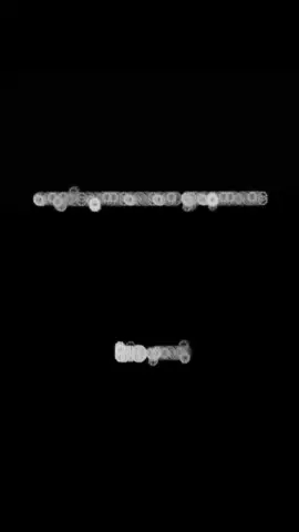 #fyp #foryou #viewsတက်စမ်းကွာ😒👊 #ဘယ်တော့မှရောက်မာလဲfypပေါ်က😣😒 #viral 