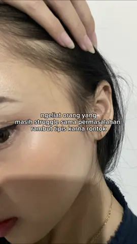 aku pernah kaya gitu juga ko😭 #perawatanrambut #shumi #rambutbotak #rambutrontok 