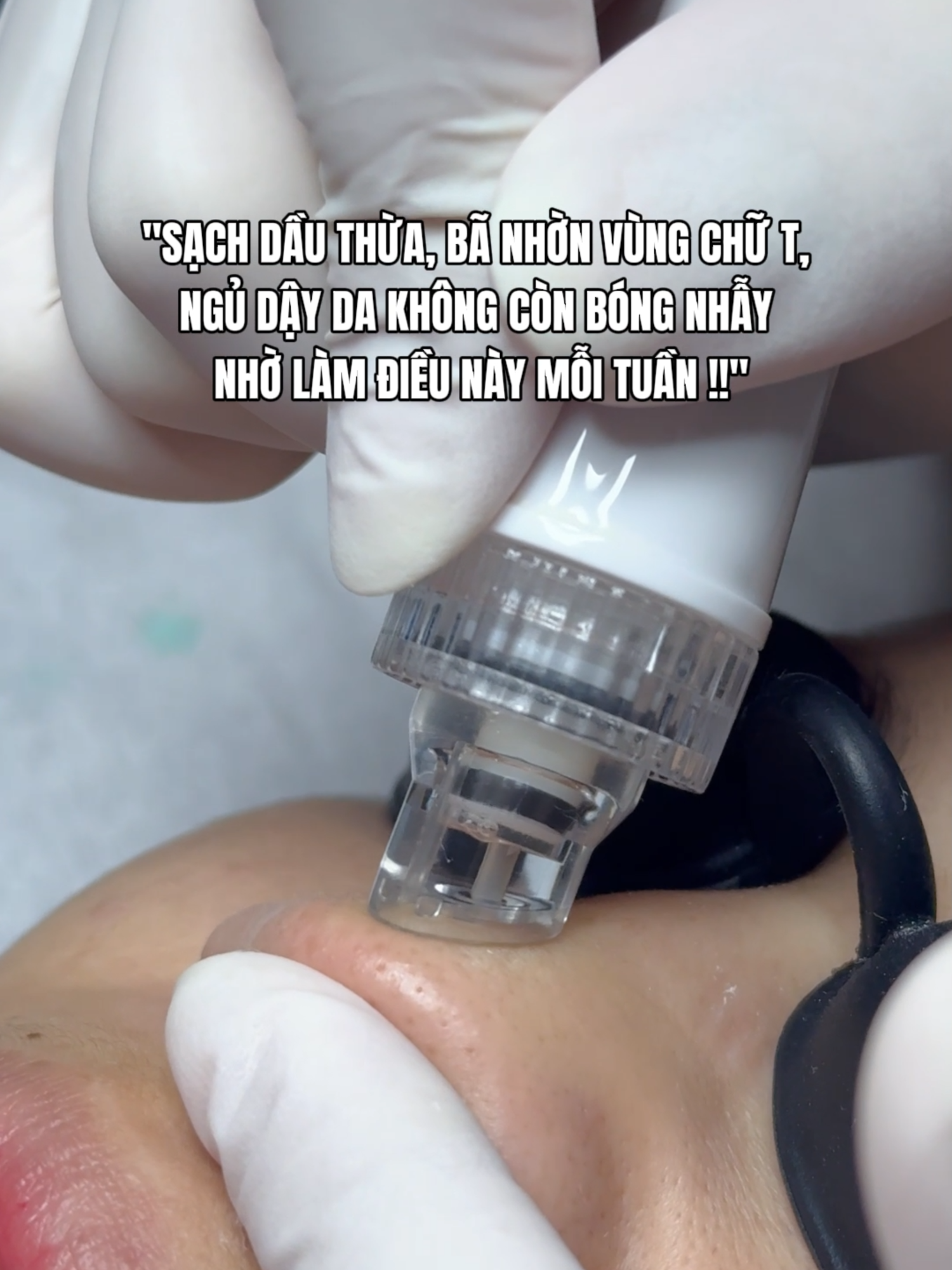 Sạch dầu thừa, bã nhờn vùng chữ T, ngủ dậy da không còn bóng nhẫy nhờ làm điều này mỗi tuần!! #mialalanhatrang #spanhatrang #aquapeel #aquapeeling #xh