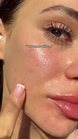 3,2,1  dark spot out ? 😍 #Purito #panthenolcream #PuritoTXAserum #BlemishOutRoutine #Realpostacnecream 