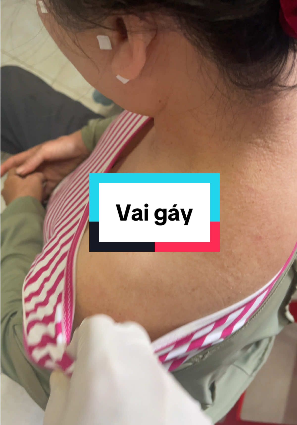 Bấm huyệt vai gáy #đauvaigáy 