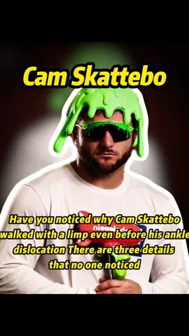 Have you noticed why Cam Skattebo walked with a limp even before his ankle dislocation There are three details that no one noticed,indicating that this dislocation was not an accident!#us #usa #fouryou #fyp #celebrity 
